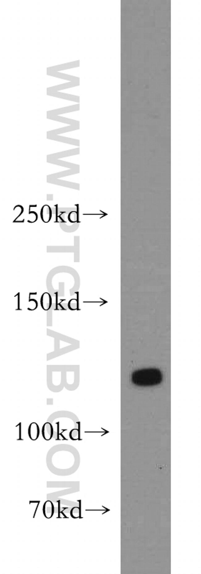 DLGAP3 Antibody in Western Blot (WB)