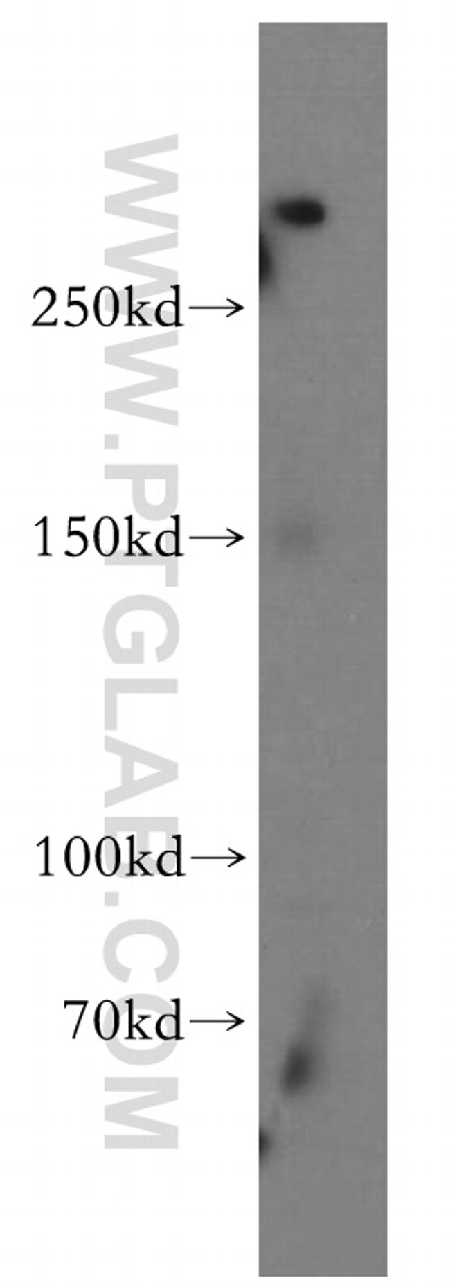 SHANK1 Antibody in Western Blot (WB)