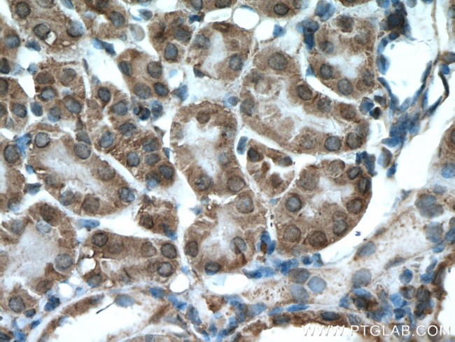 XYLT1 Antibody in Immunohistochemistry (Paraffin) (IHC (P))