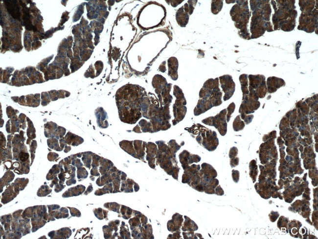 XYLT1 Antibody in Immunohistochemistry (Paraffin) (IHC (P))