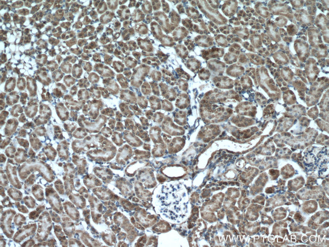 XYLT1 Antibody in Immunohistochemistry (Paraffin) (IHC (P))