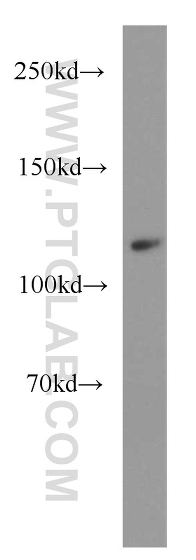 XYLT1 Antibody in Western Blot (WB)