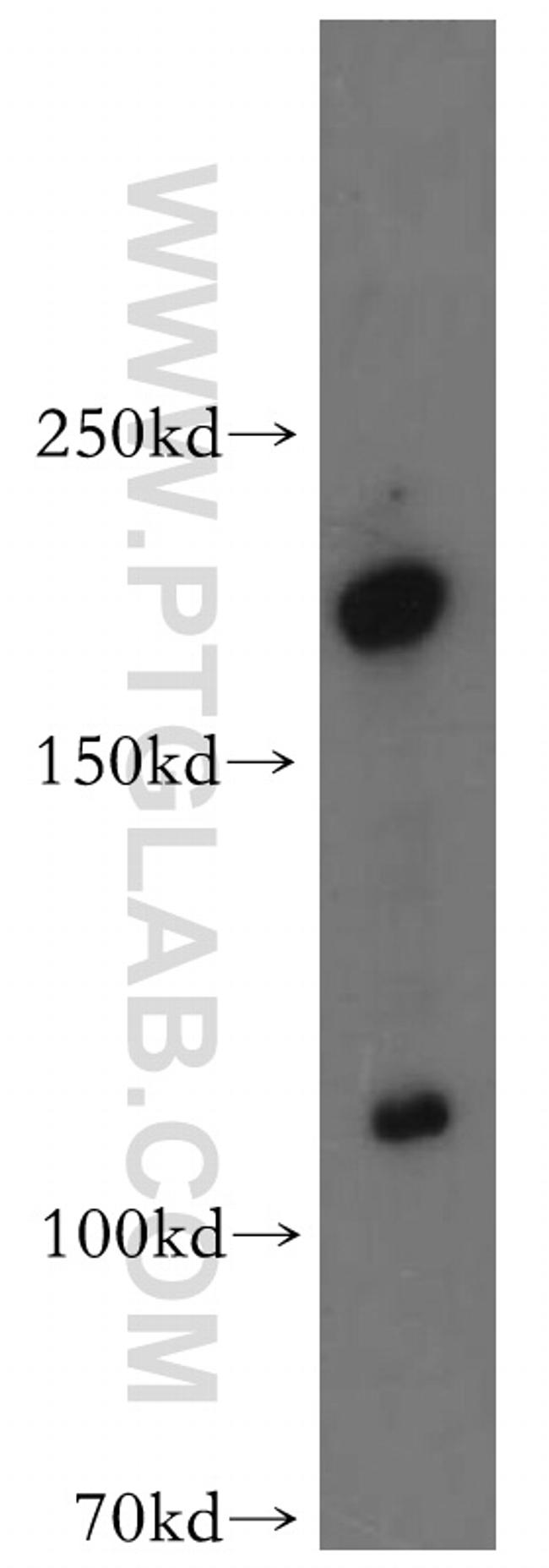 ADCY1 Antibody in Western Blot (WB)