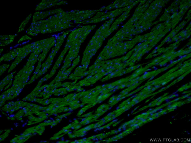 MTCO2 Antibody in Immunohistochemistry (PFA fixed) (IHC (PFA))