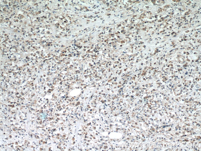 MTCO2 Antibody in Immunohistochemistry (Paraffin) (IHC (P))