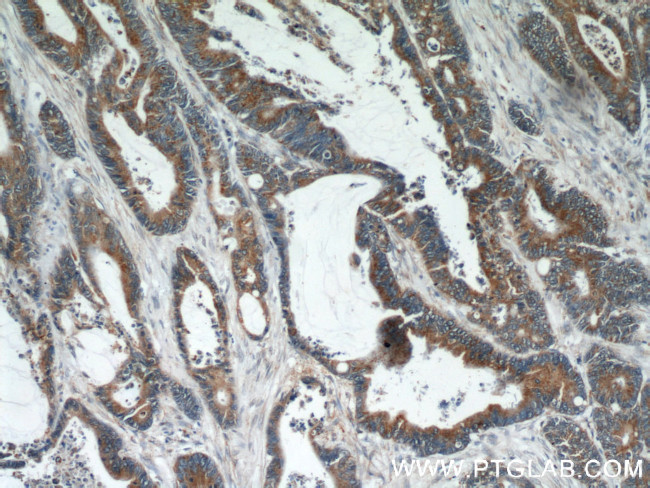 MTCO2 Antibody in Immunohistochemistry (Paraffin) (IHC (P))