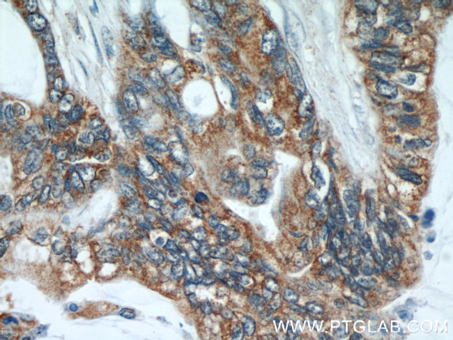 MTCO2 Antibody in Immunohistochemistry (Paraffin) (IHC (P))