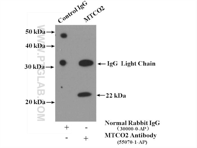 MTCO2 Antibody in Immunoprecipitation (IP)