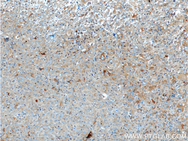 PLA2G4B Antibody in Immunohistochemistry (Paraffin) (IHC (P))