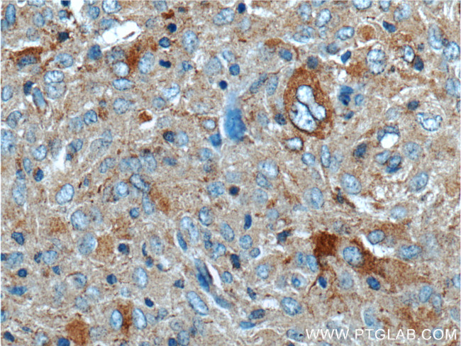 PLA2G4B Antibody in Immunohistochemistry (Paraffin) (IHC (P))