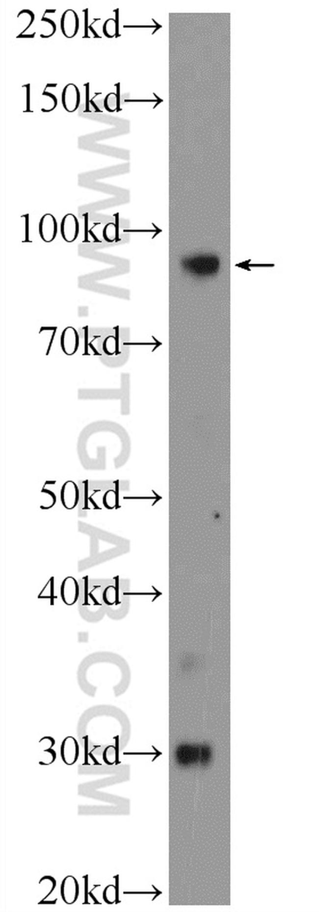 PLA2G4B Antibody in Western Blot (WB)