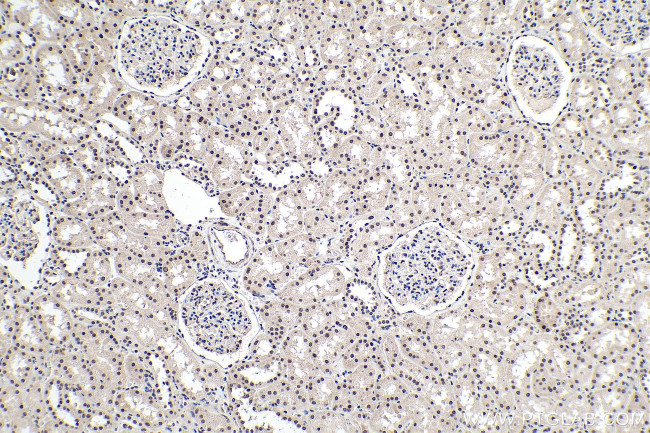 PDGFC Antibody in Immunohistochemistry (Paraffin) (IHC (P))