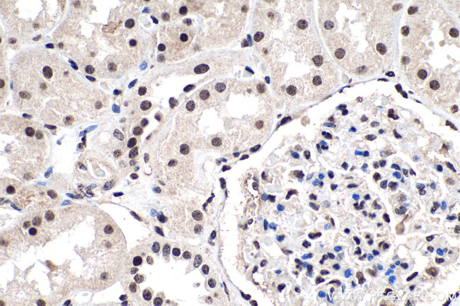 PDGFC Antibody in Immunohistochemistry (Paraffin) (IHC (P))