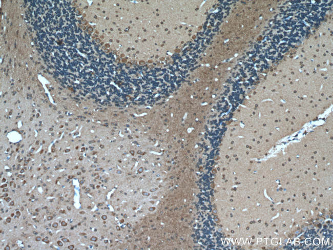 MTCO3 Antibody in Immunohistochemistry (Paraffin) (IHC (P))