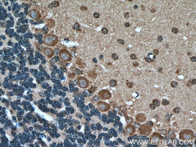 MTCO3 Antibody in Immunohistochemistry (Paraffin) (IHC (P))