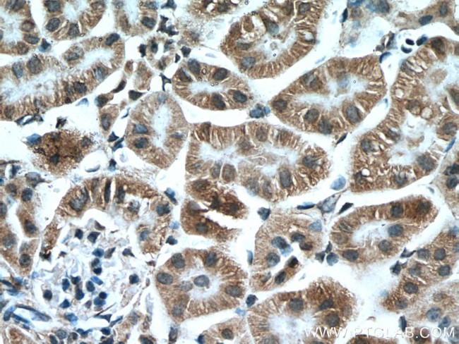 MTCO3 Antibody in Immunohistochemistry (Paraffin) (IHC (P))