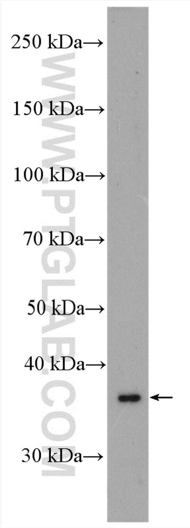 MTCO3 Antibody in Western Blot (WB)