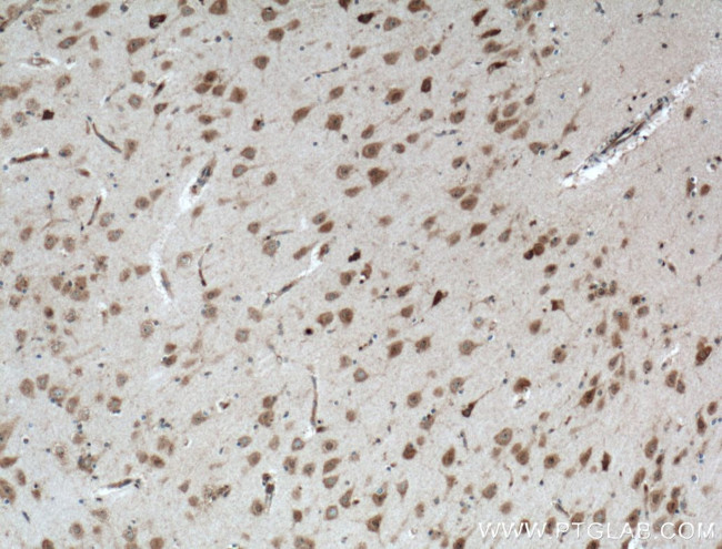 DRD2 Antibody in Immunohistochemistry (Paraffin) (IHC (P))