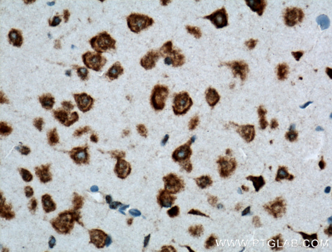 DRD2 Antibody in Immunohistochemistry (Paraffin) (IHC (P))