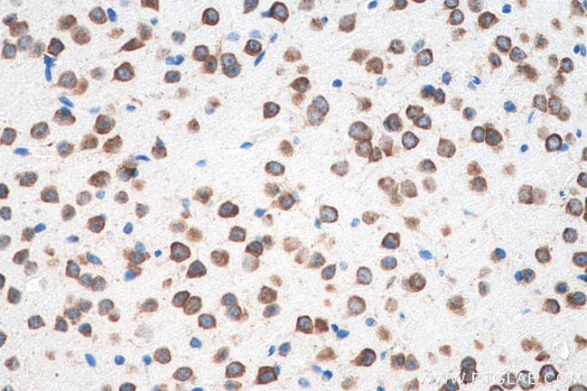 DRD2 Antibody in Immunohistochemistry (Paraffin) (IHC (P))