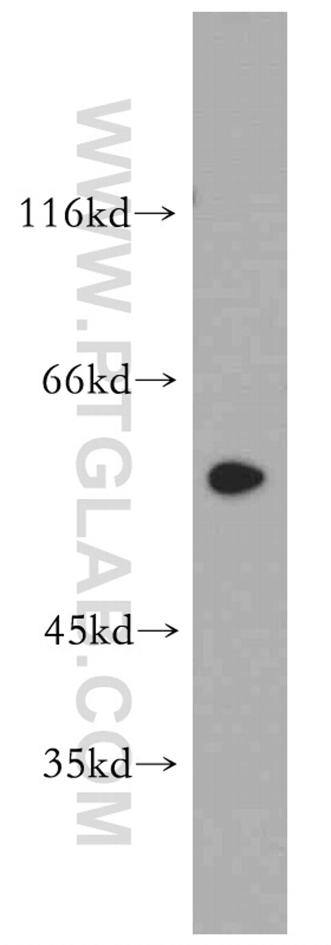 DRD2 Antibody in Western Blot (WB)