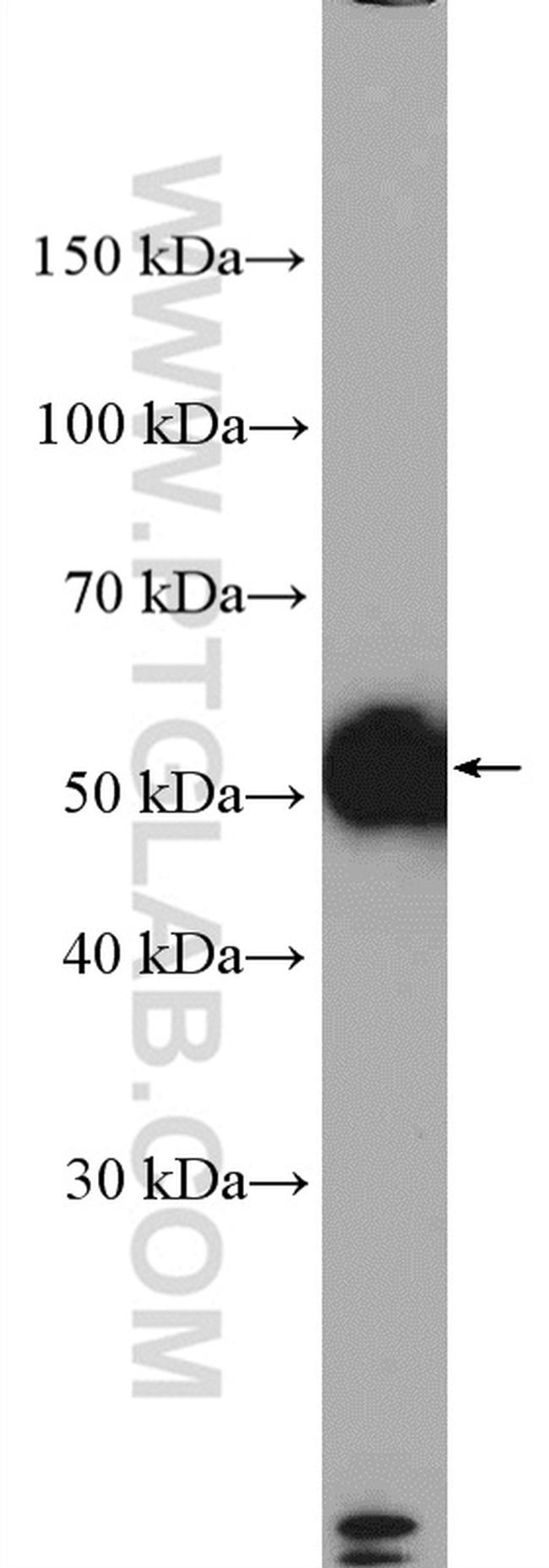 DRD2 Antibody in Western Blot (WB)