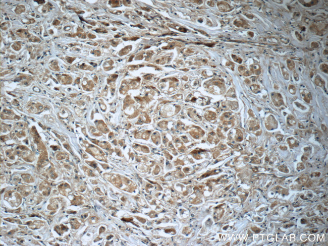 PRDX3 Antibody in Immunohistochemistry (Paraffin) (IHC (P))