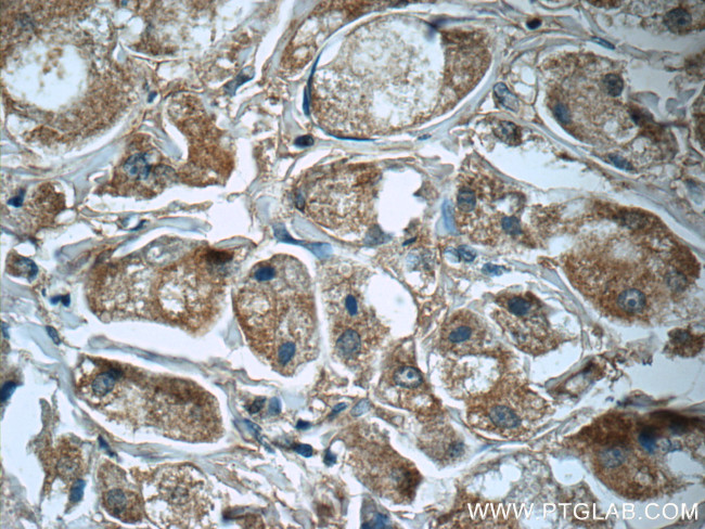 PRDX3 Antibody in Immunohistochemistry (Paraffin) (IHC (P))