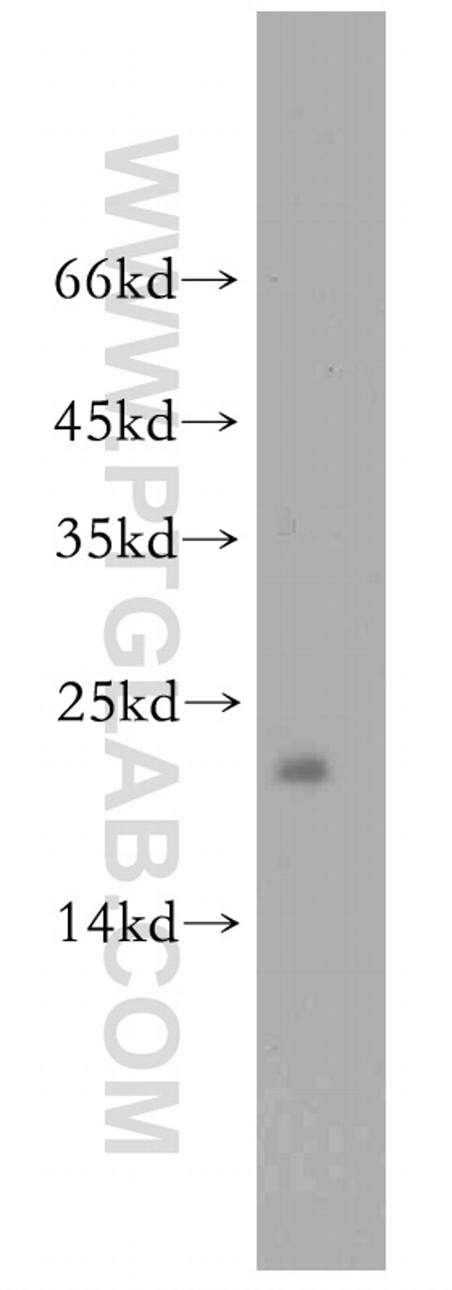 PRDX3 Antibody in Western Blot (WB)