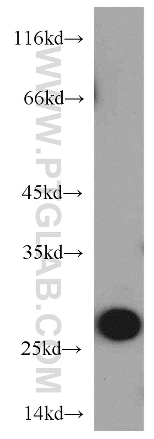 PRDX3 Antibody in Western Blot (WB)