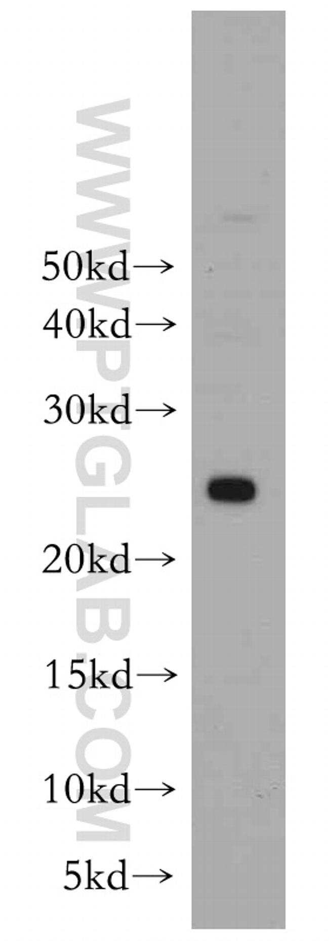 PRDX3 Antibody in Western Blot (WB)