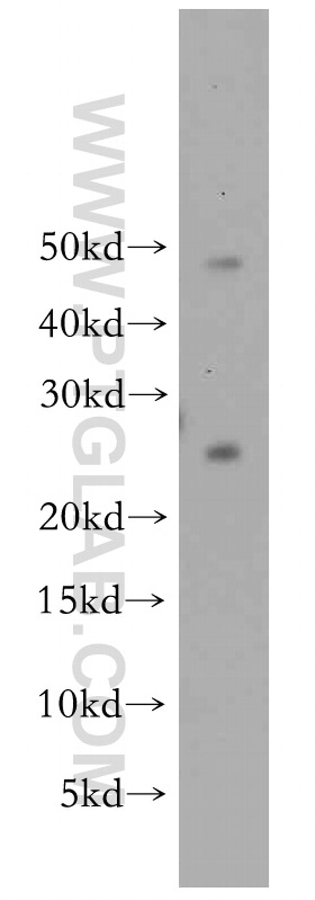 PRDX3 Antibody in Western Blot (WB)