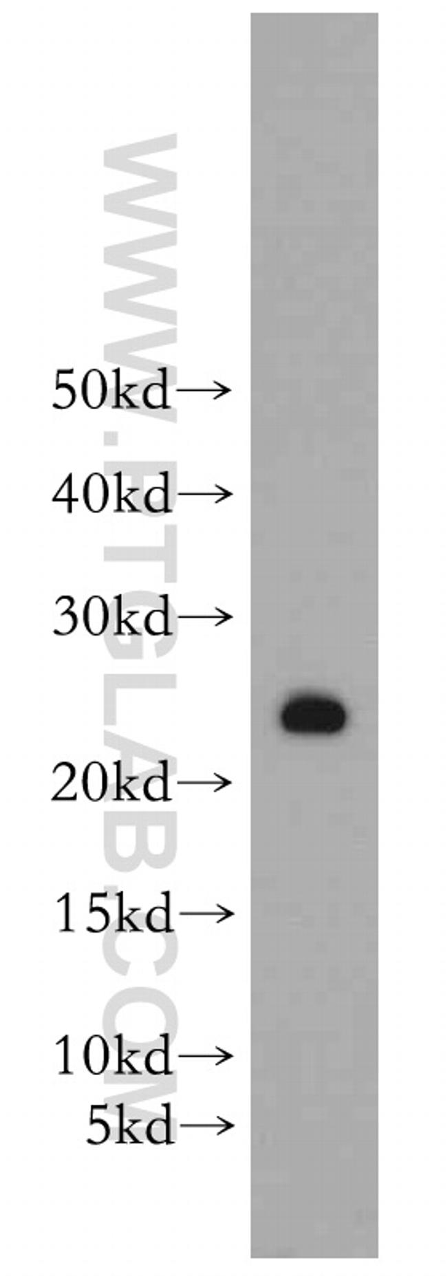 PRDX3 Antibody in Western Blot (WB)