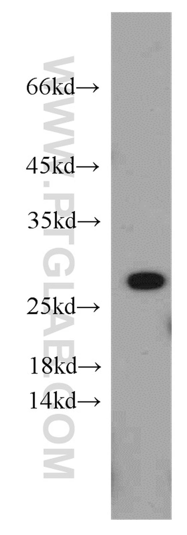 PRDX3 Antibody in Western Blot (WB)