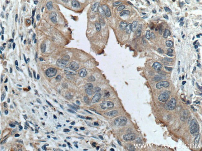 Frizzled 8 Antibody in Immunohistochemistry (Paraffin) (IHC (P))