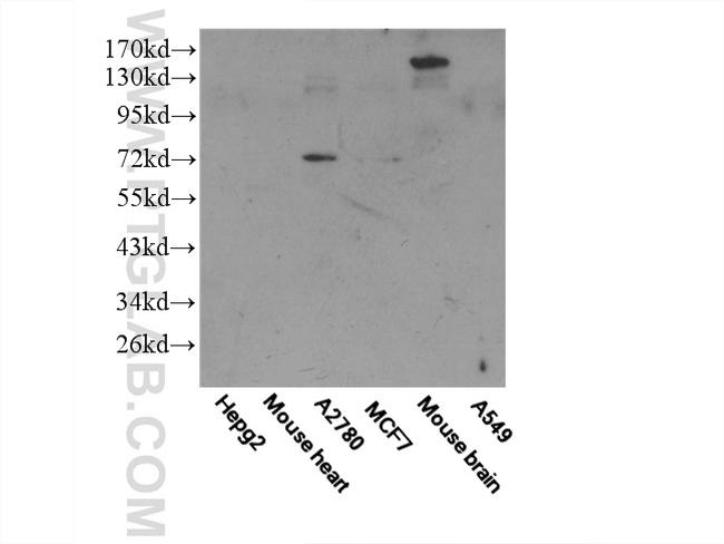 Frizzled 8 Antibody in Western Blot (WB)