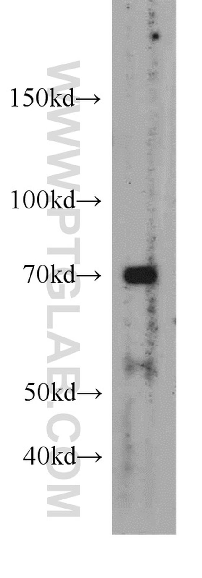 Frizzled 8 Antibody in Western Blot (WB)