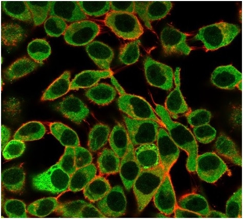 SAMD4B (Transcription Factor) Antibody in Immunocytochemistry (ICC/IF)