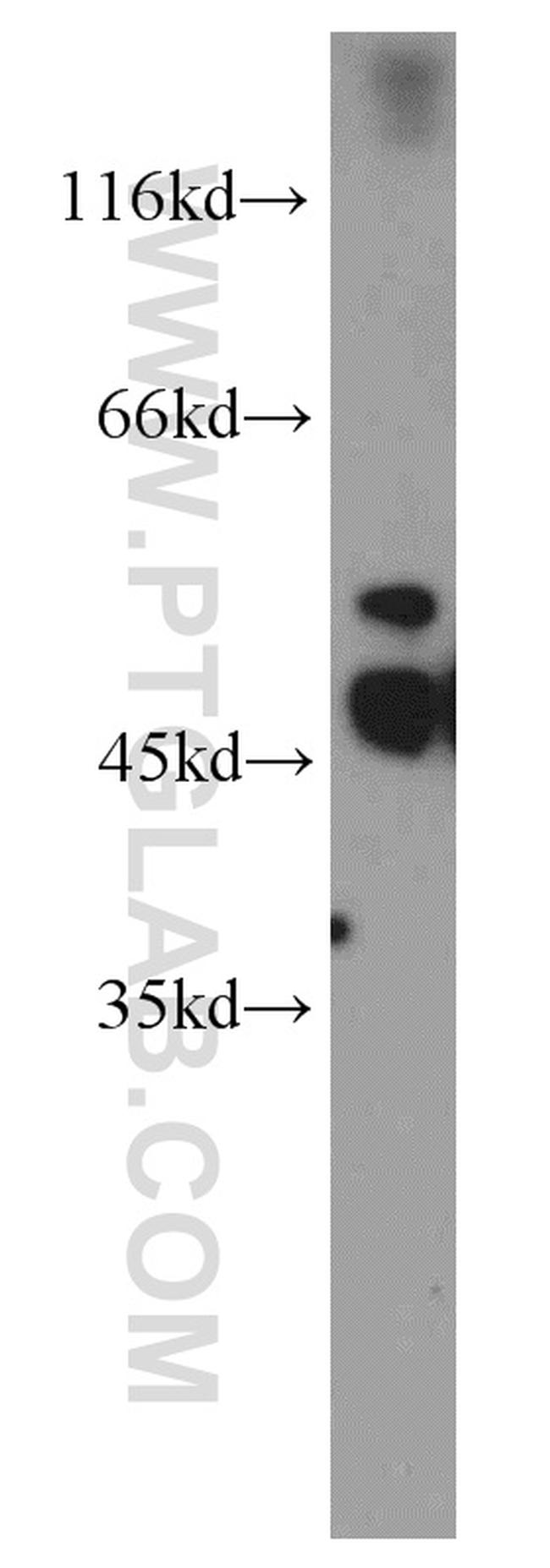 PKMYT1 Antibody in Western Blot (WB)