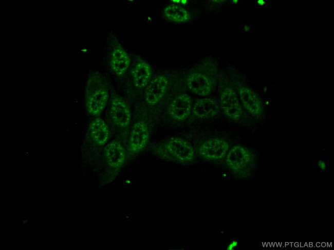 SPI1 Antibody in Immunocytochemistry (ICC/IF)