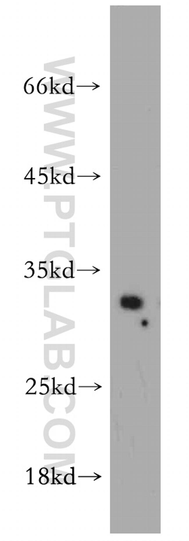 SPI1 Antibody in Western Blot (WB)