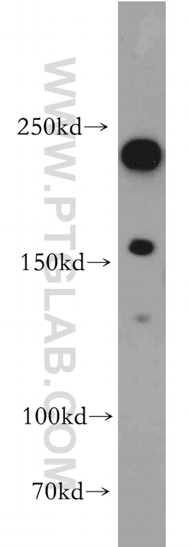 AF-6 Antibody in Western Blot (WB)