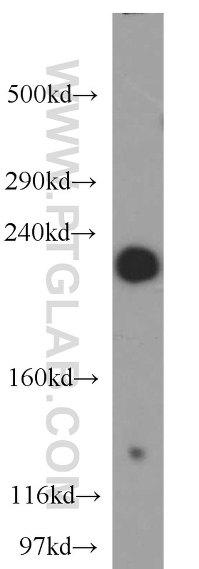 AF-6 Antibody in Western Blot (WB)