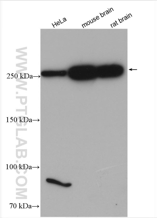 SPTBN2 Antibody in Western Blot (WB)