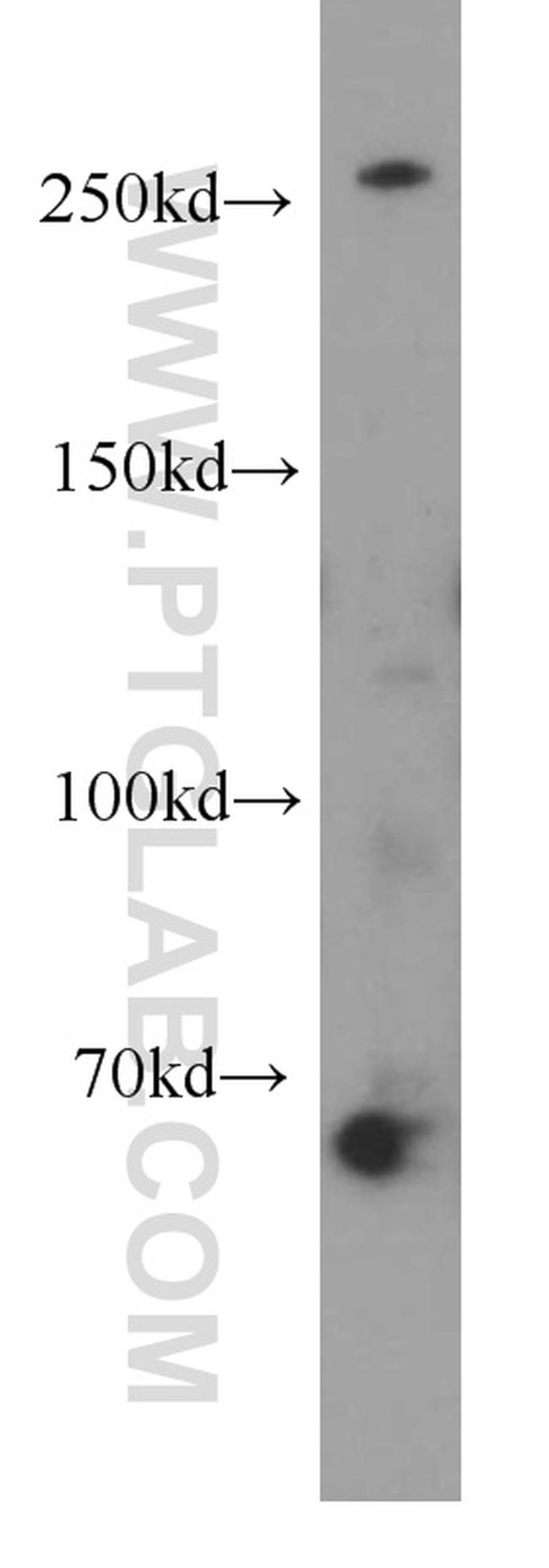 SPTBN2 Antibody in Western Blot (WB)