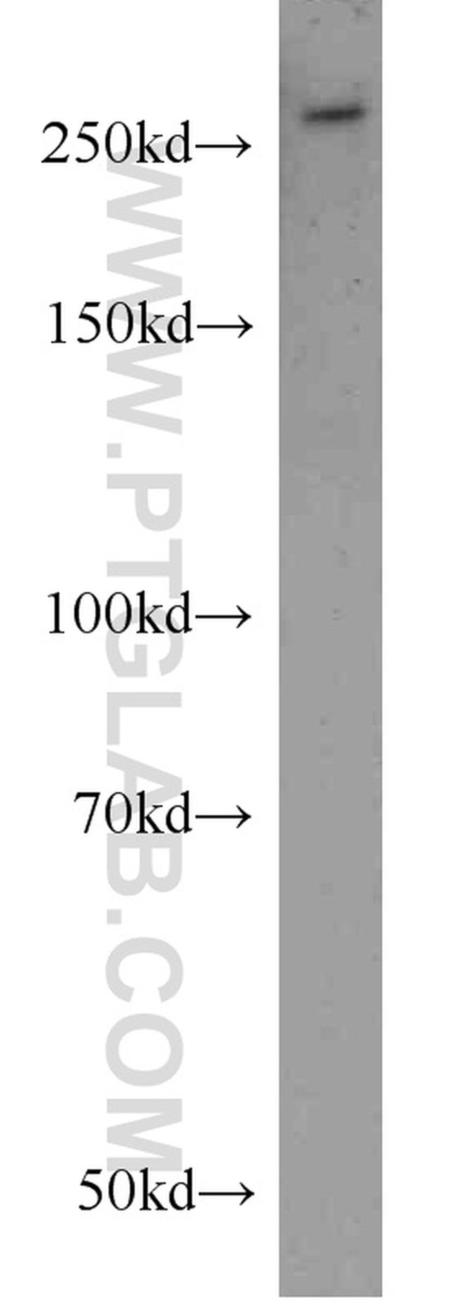 SPTBN2 Antibody in Western Blot (WB)