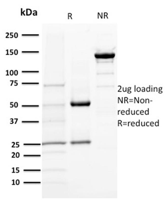 DOG-1/TMEM16A Antibody in SDS-PAGE (SDS-PAGE)