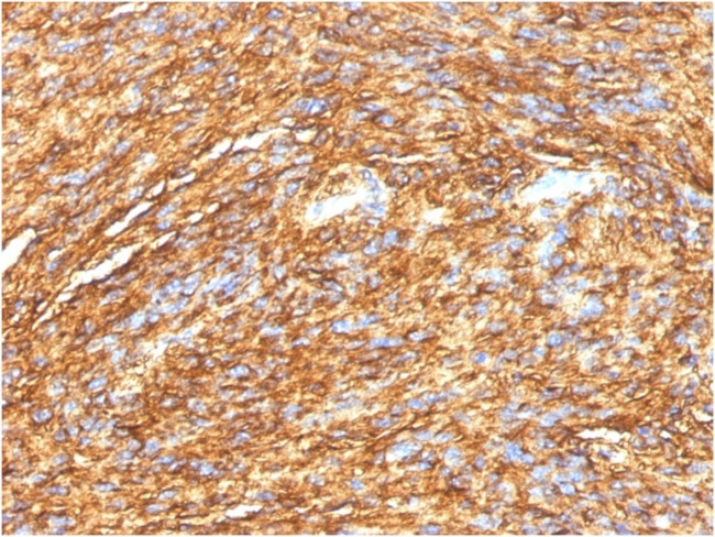 DOG-1/TMEM16A Antibody in Immunohistochemistry (Paraffin) (IHC (P))