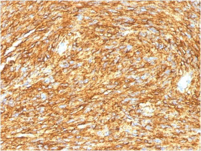 DOG-1/TMEM16A Antibody in Immunohistochemistry (Paraffin) (IHC (P))