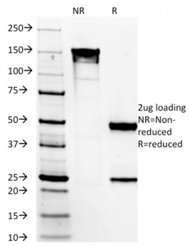 DOG-1/TMEM16A Antibody in SDS-PAGE (SDS-PAGE)